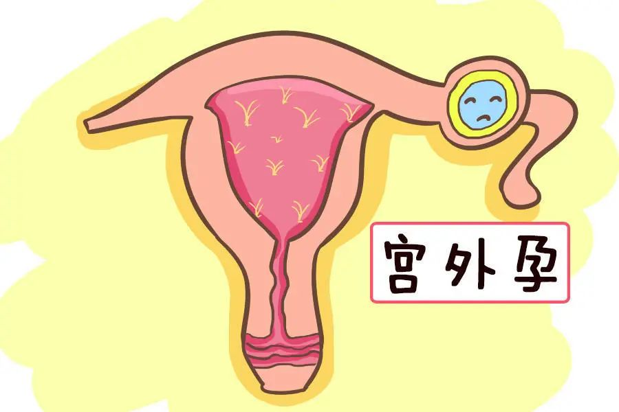 640 (7).png